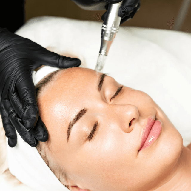 Microneedling 3txs