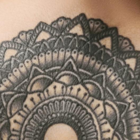 Tattoo Removal (XXSmall) 8txs