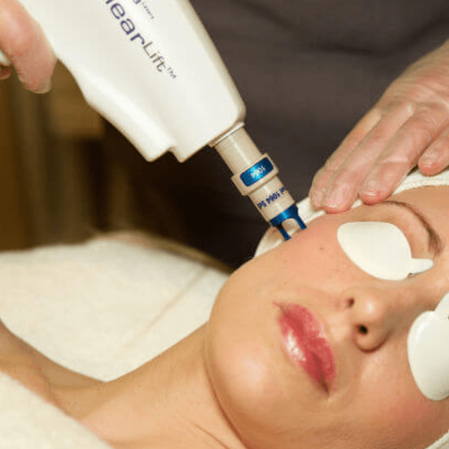 Clearlift Facial 4tx